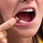 O que significa sonhar com dentes caindo ou quebrados Descubra interpretações