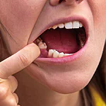 O que significa sonhar com dentes caindo ou quebrados Descubra interpretações